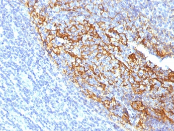 IHC staining of FFPE human tonsil with CD35 antibody (clone To5). HIER: boil tissue sections in pH 9 10mM Tris with 1mM EDTA for 10-20 min and allow to cool before testing.~