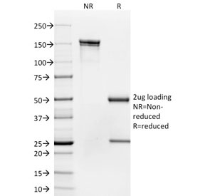 SDS-PAGE analysis of purified, BSA-free CD35 antibody (clone To