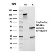 SDS-PAGE analysis of purified, BSA-free recombinant CD21 antibody (clone rCR2/1952) as confirmation of integrity and purity.