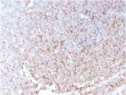 IHC staining of FFPE human spleen with recombinant CD21 antibody (clone rCR2/1952). HIER: boil tissue sections in pH 9 10mM Tris with 1mM EDTA for 10-20 min and allow to cool before testing.