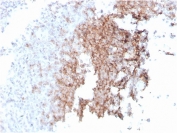 IHC staining of FFPE human spleen with recombinant CD21 antibody (clone rCR2/1952). HIER: boil tissue sections in pH 9 10mM Tris with 1mM EDTA for 10-20 min and allow to cool before testing.