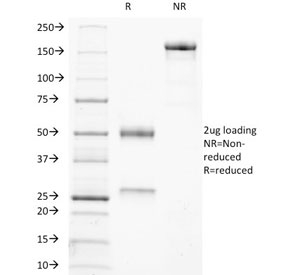 SDS-PAGE analysis of purified, BSA-free CD21 antibody (clone CR2/3247) as confirmation of integrity and purity.