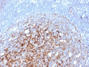 IHC staining of FFPE human tonsil with CD21 antibody (clone CR2/3247). HIER: boil tissue sections in pH 9 10mM Tris with 1mM EDTA for 10-20 min and allow to cool before testing.