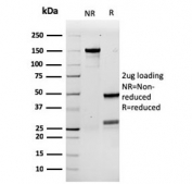 SDS-PAGE analysis of purified, BSA-free recombinant Granulocyte-Colony Stimulating Factor antibody (clone rCSF3/900) as confirmation of integrity and purity.