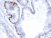 IHC staining of FFPE human prostate with Cystatin A antibody (clone CPTC-CSTA-1). HIER: boil tissue sections in pH 9 10mM Tris with 1mM EDTA for 10-20 min and allow to cool before testing.