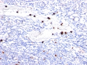 IHC staining of FFPE human tonsil with Cystatin A antibody (clone CPTC-CSTA-1). HIER: boil tissue sections in pH 9 10mM Tris with 1mM EDTA for 10-20 min and allow to cool before testing.