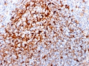 IHC staining of FFPE human tonsil with Cystatin A antibody (clone CPTC-CSTA-1). HIER: boil tissue sections in pH 9 10mM Tris with 1mM EDTA for 10-20 min and allow to cool before testing.