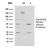 SDS-PAGE analysis of purified, BSA-free Cystatin A antibody (clone CPTC-CSTA-1) as confirmation of integrity and purity.