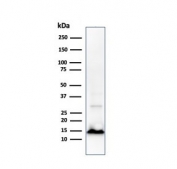 Western blot testing of Cystatin A antibody and human A431 cell lysate (clone CPTC-CSTA-1). Predicted molecular weight ~11 kDa.