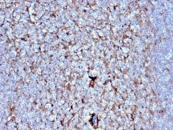 IHC staining of FFPE human tonsil with Cystatin A antibody (clone CSTA/2882). HIER: boil tissue sections in pH 9 10mM Tris with 1mM EDTA for 10-20 min and allow to cool before testing.
