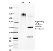 SDS-PAGE analysis of purified, BSA-free CTLA4 antibody (clone L4P2F5.F10) as confirmation of integrity and purity.