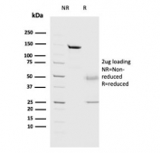 SDS-PAGE analysis of purified, BSA-free Cathepsin D antibody (clone CTSD/3082) as confirmation of integrity and purity.