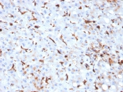 IHC staining of FFPE human liver with Cathepsin K antibody (clone CTSK/2793). HIER: boil tissue sections in pH 9 10mM Tris with 1mM EDTA for 10-20 min and allow to cool before testing.