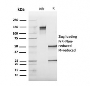 SDS-PAGE analysis of purified, BSA-free Cathepsin K antibody (clone CTSK/2793) as confirmation of integrity and purity.