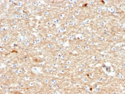 IHC staining of FFPE human brain with Drebrin antibody (clone DBN1/2880). HIER: boil tissue sections in pH 9 10mM Tris with 1mM EDTA for 10-20 min followed by cooling at RT for 20 min.