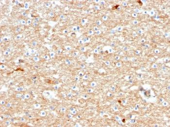 IHC staining of FFPE human brain with Drebrin antibody (clone DBN1/2880). HIER: boil tissue sections in pH 9 10mM Tris with 1mM EDTA for 10-20 min followed by cooling at RT for 20 min.