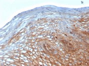 IHC staining of FFPE human cervix with Drebrin 1 antibody (clone DBN1/2880). HIER: boil tissue sections in pH 9 10mM Tris with 1mM EDTA for 10-20 min followed by cooling at RT for 20 min.