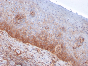 IHC staining of FFPE human cervix with Drebrin 1 antibody (clone DBN1/3393). HIER: boil tissue sections in pH 9 10mM Tris with 1mM EDTA for 10-20 min followed by cooling at RT for 20 min.