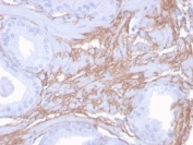 IHC staining of FFPE human prostate with Decorin antibody (clone DCN/3523). HIER: boil tissue sections in pH 9 10mM Tris with 1mM EDTA for 10-20 min and allow to cool before testing.