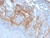 IHC staining of FFPE human skin with Decorin antibody (clone DCN/3523). HIER: boil tissue sections in pH 9 10mM Tris with 1mM EDTA for 10-20 min and allow to cool before testing.