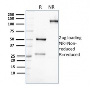 SDS-PAGE analysis of purified, BSA-free AKR1C2 antibody (clone CPTC-AKR1C2-1) as confirmation of integrity and purity.