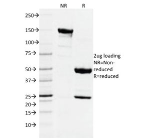 SDS-PAGE analysis of purified, BSA-free DNMT1 antibody as confirmation of integrity and purity.
