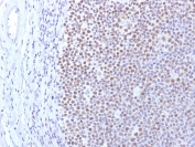 IHC staining of FFPE human tonsil with DNMT1 antibody. HIER: boil tissue sections in pH 9 10mM Tris with 1mM EDTA for 10-20 min and allow to cool before testing.