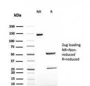 SDS-PAGE analysis of purified, BSA-free recombinant TAG-72 antibody (clone rB72.3) as confirmation of integrity and purity.