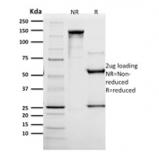 SDS-PAGE analysis of purified, BSA-free HER2 antibody (clone SPM172) as confirmation of integrity and purity.