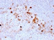 IHC staining of FFPE human tonsil with CD105 antibody (clone ENG/3269). HIER: boil tissue sections in pH 9 10mM Tris with 1mM EDTA for 10-20 min and allow to cool before testing.