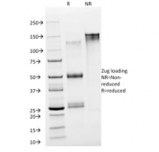 SDS-PAGE analysis of purified, BSA-free NSE antibody (clone NSE-P2) as confirmation of integrity and purity.