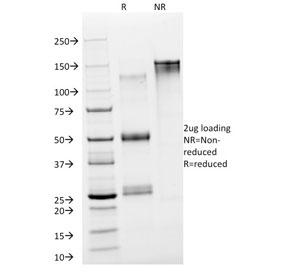 SDS-PAGE analysis of purified, BSA-free NSE antibody as confir