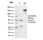 SDS-PAGE analysis of purified, BSA-free recombinant EPO antibody (clone rEPO/1367) as confirmation of integrity and purity.