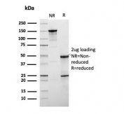 SDS-PAGE analysis of purified, BSA-free HER2 antibody (clone ERBB2/3078) as confirmation of integrity and purity.