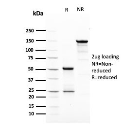 SDS-PAGE analysis of purified, BSA-free HER2 antibody (clone ERBB2/3079) as confirmation of integrity and purity.