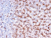 IHC staining of FFPE human liver with Cathepsin D antibody (clone CTSD/3276). HIER: boil tissue sections in pH 9 10mM Tris with 1mM EDTA for 10-20 min and allow to cool before testing.