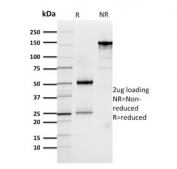 SDS-PAGE analysis of purified, BSA-free Cathepsin D antibody (clone CTSD/3276) as confirmation of integrity and purity.