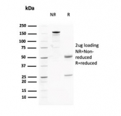 SDS-PAGE analysis of purified, BSA-free AKT1 antibody (clone AKT1/2784) as confirmation of integrity and purity.