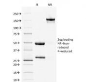 SDS-PAGE analysis of purified, BSA-free Estrogen Receptor alpha antibody (clone ESR1/1904) as confirmation of integrity and purity.