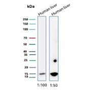 CSF3 Antibody Human Liver WB. Western blot analysis of Granulocyte colony stimulating factor / CSF3 in human liver tissue lysates using rabbit monoclonal CSF3 antibody, clone CSF3/3166R. Two lanes are shown at different antibody dilutions (1:100 and 1:50), with bands detected at approximately 18-20 kDa, consistent with the predicted molecular weight of G-CSF, supporting detection of this hematopoietic cytokine in liver tissue.