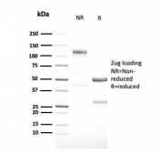 SDS-PAGE analysis of purified, BSA-free recombinant GCSF antibody (clone CSF3/3166R) as confirmation of integrity and purity.