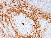 IHC staining of FFPE human tonsil with recombinant GCSF antibody (clone CSF3/3166R). HIER: boil tissue sections in pH 9 10mM Tris with 1mM EDTA for 10-20 min and allow to cool before testing.