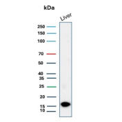 CSF3 Antibody Liver Tissue WB. Western blot analysis of Granulocyte colony stimulating factor / CSF3 in human liver tissue lysate using rabbit monoclonal CSF3 antibody, clone CSF3/3166R. A band is detected at approximately 18-20 kDa, consistent with the predicted molecular weight of G-CSF, supporting detection of this hematopoietic cytokine in liver tissue.