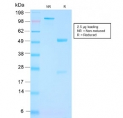SDS-PAGE analysis of purified, BSA-free recombinant FOLH1 antibody as confirmation of integrity and purity.