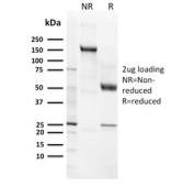 SDS-PAGE analysis of purified, BSA-free recombinant CD21 antibody (clone CR2/3124R) as confirmation of integrity and purity.