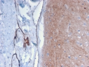 IHC staining of FFPE human brain with Drebrin 1 antibody (clone DBN1/2879). HIER: boil tissue sections in pH 9 10mM Tris with 1mM EDTA for 10-20 min followed by cooling at RT for 20 min.