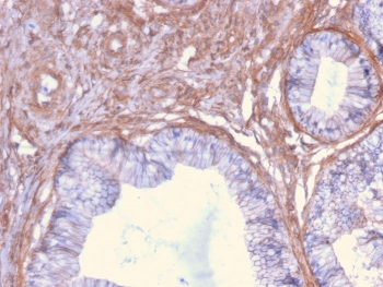 IHC staining of FFPE human cervix with Drebrin 1 antibody (clone DBN1/2879). HIER: boil tissue sections in pH 9 10mM Tris with 1mM EDTA for 10-20 min followed by cooling at RT for 20 min.