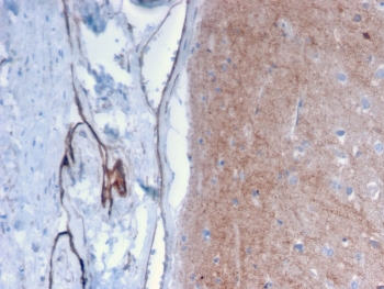 IHC staining of FFPE human brain with Drebrin 1 antibody (clone DBN1/2879). HIER: boil tissue sections in pH 9 10mM Tris with 1mM EDTA for 10-20 min followed by cooling at RT for 20 min.