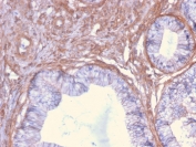 IHC staining of FFPE human cervix with Drebrin 1 antibody (clone DBN1/2879). HIER: boil tissue sections in pH 9 10mM Tris with 1mM EDTA for 10-20 min followed by cooling at RT for 20 min.IHC staining of FFPE human cervix with Drebrin 1 antibody (clone DBN1/2879). HIER: boil tissue sections in pH 9 10mM Tris with 1mM EDTA for 10-20 min followed by cooling at RT for 20 min.