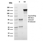 SDS-PAGE analysis of purified, BSA-free Estrogen Receptor beta antibody (clone ESR2/3005) as confirmation of integrity and purity.